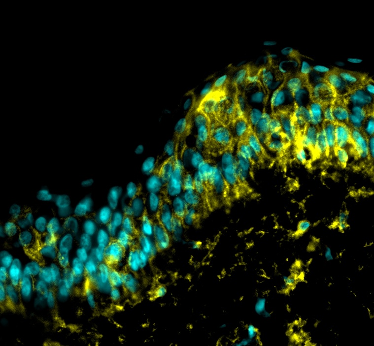 Condition stress + 1-LGVTY®