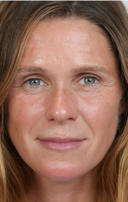 Image d’avant/après